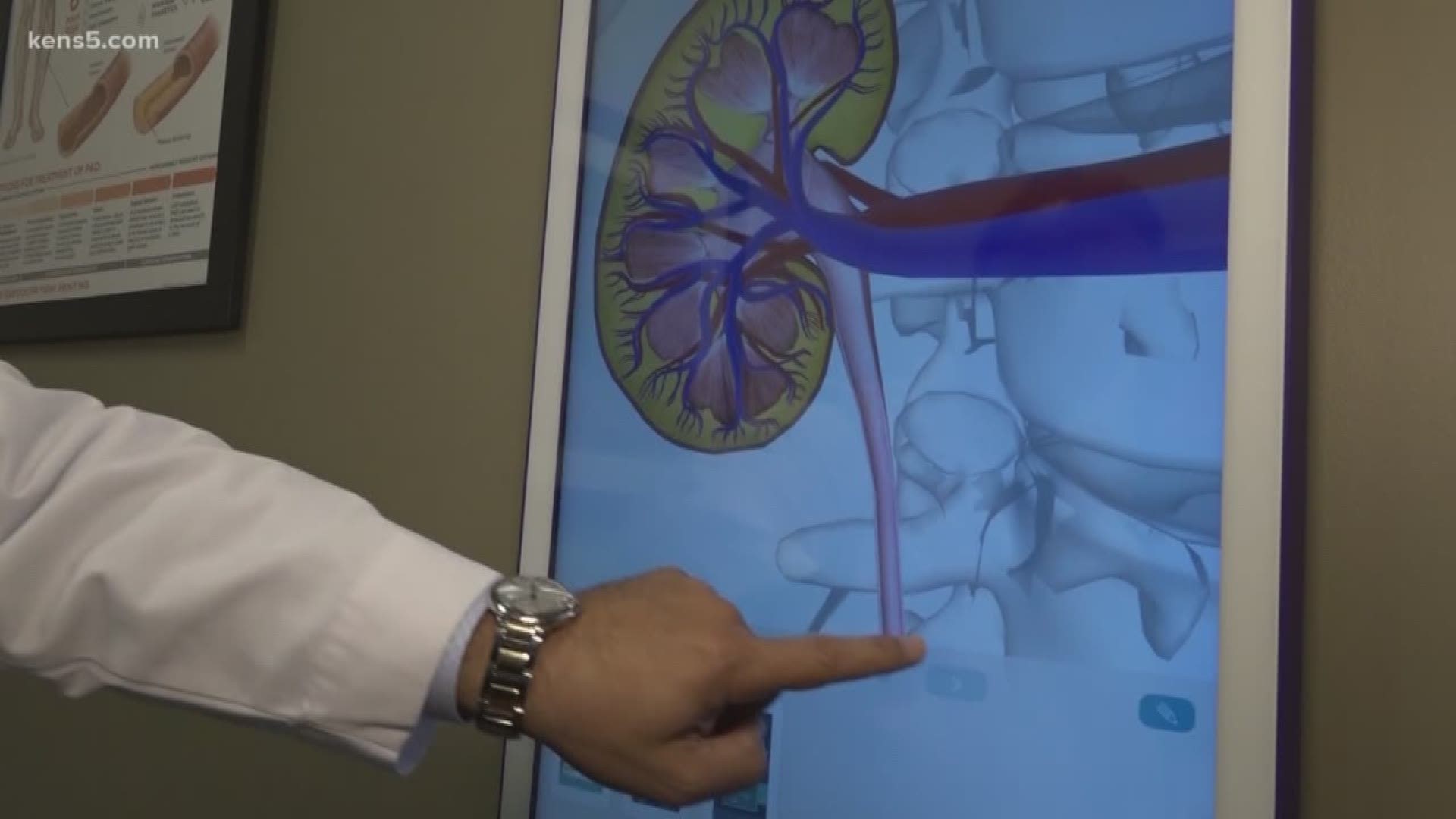 Don't kid with your kidneys: There's a new push to get San Antonians tested for kidney disease. Doctors say many people don't even realize they have it.
