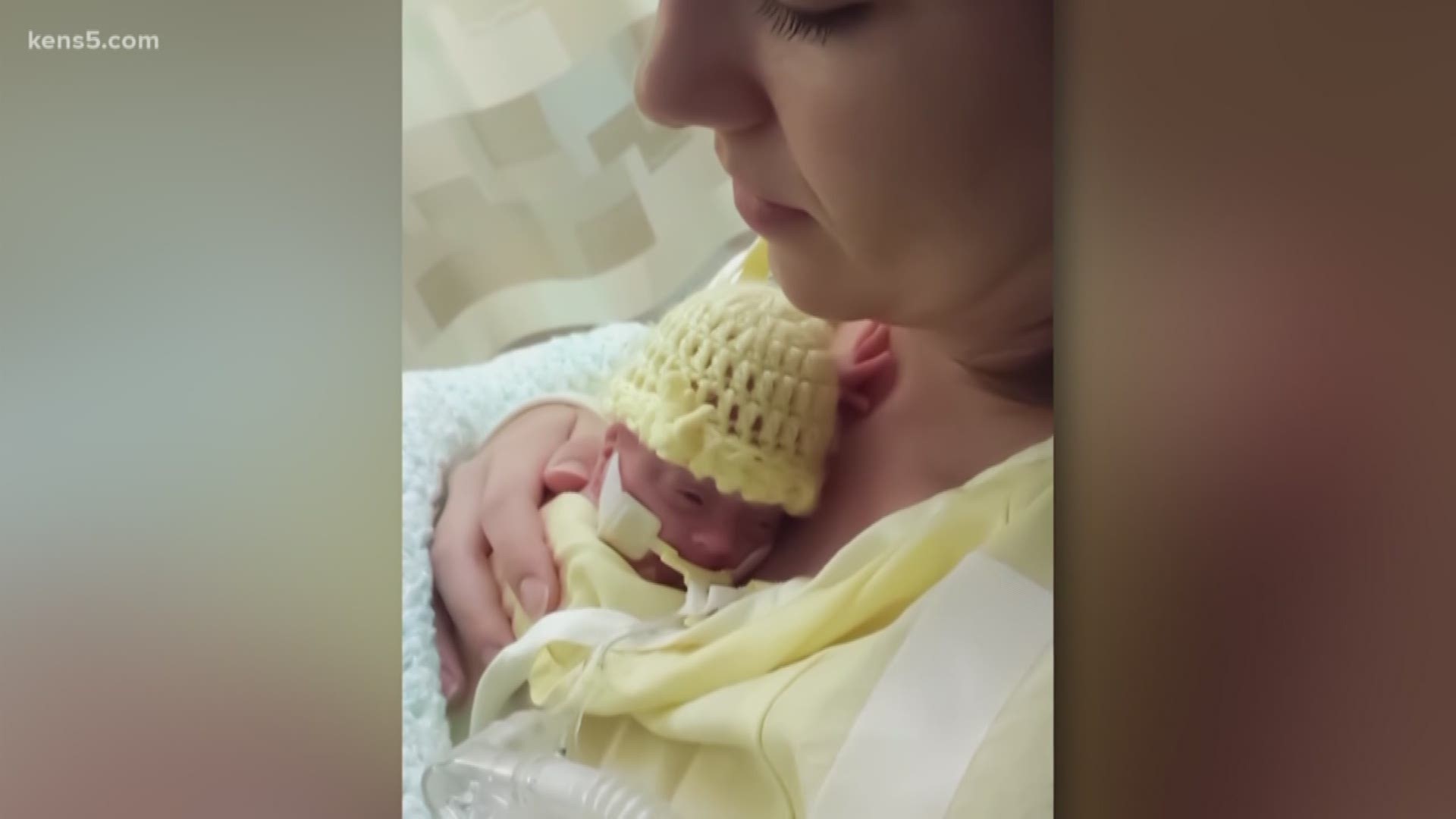 Her mother calls her a rock star. On July 11, 2014, Lyla was born at just 21 weeks, and a local doctor make the decision to give her a fighting chance.