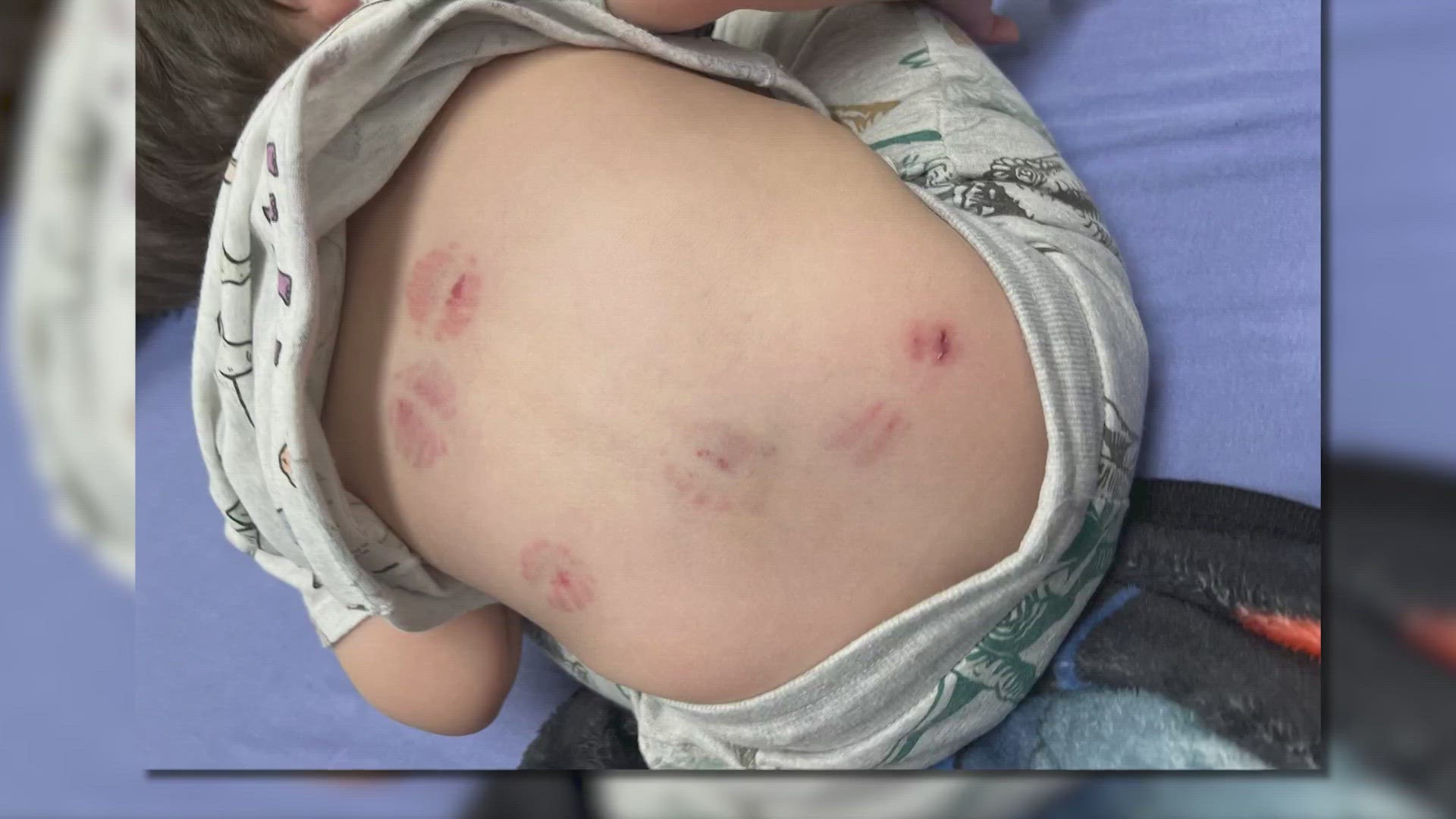 The father of Noah Rivas said he picked him up and noticed weird marks on his baby's arms. That night, Noah's mother found six more bite marks on his back.