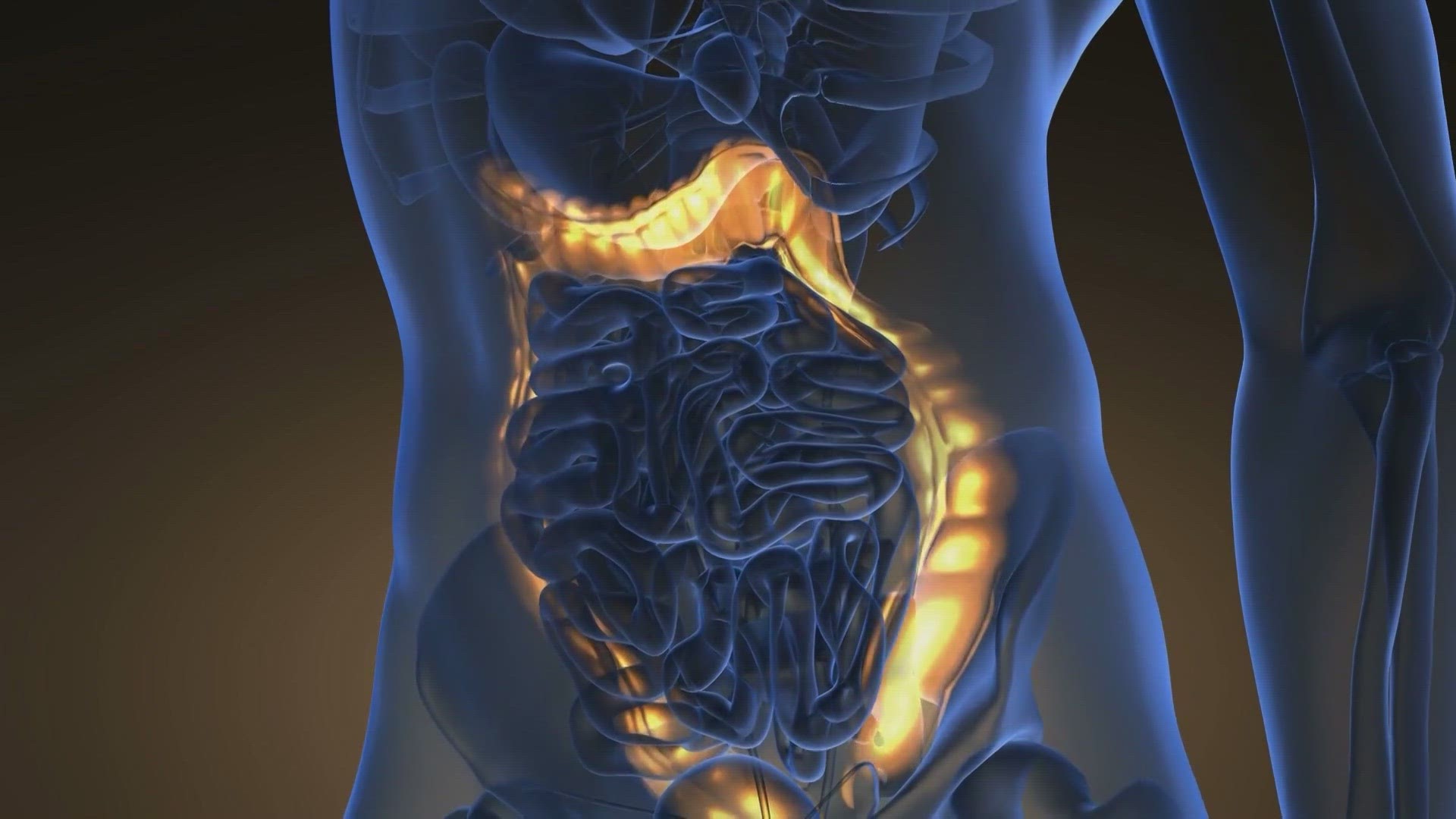 March is colorectal cancer awareness month, a time to promote screenings for a deadly disease.