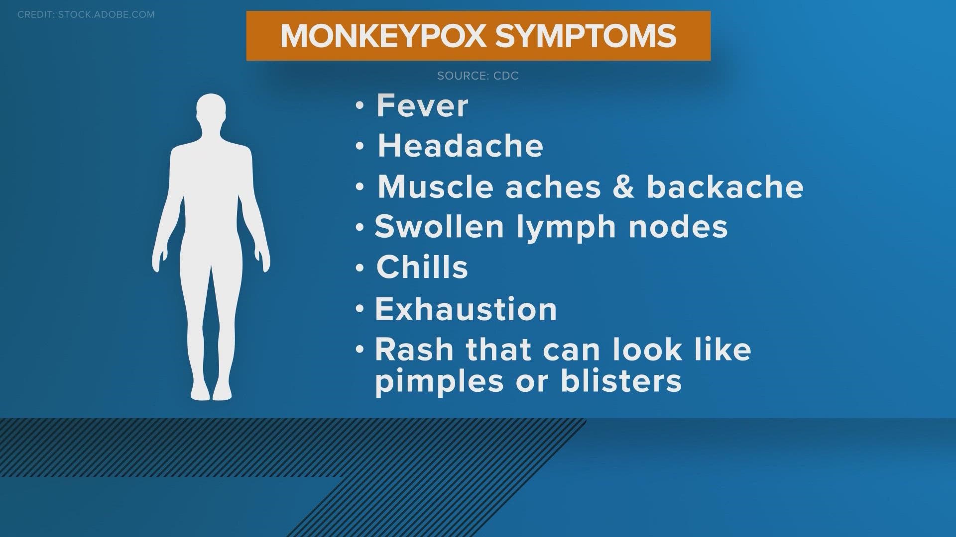 Two cases of monkeypox have been confirmed in Bexar County, San Antonio Metro Health says.
