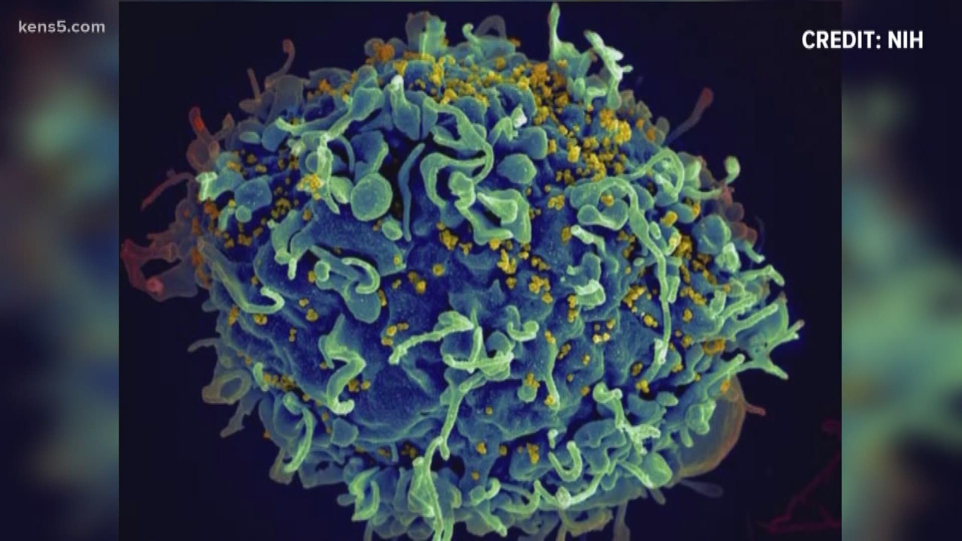 Scientists at the Texas Biomedical Research Institute say a potentially universal treatment could be the long-term result in the global fight against HIV.