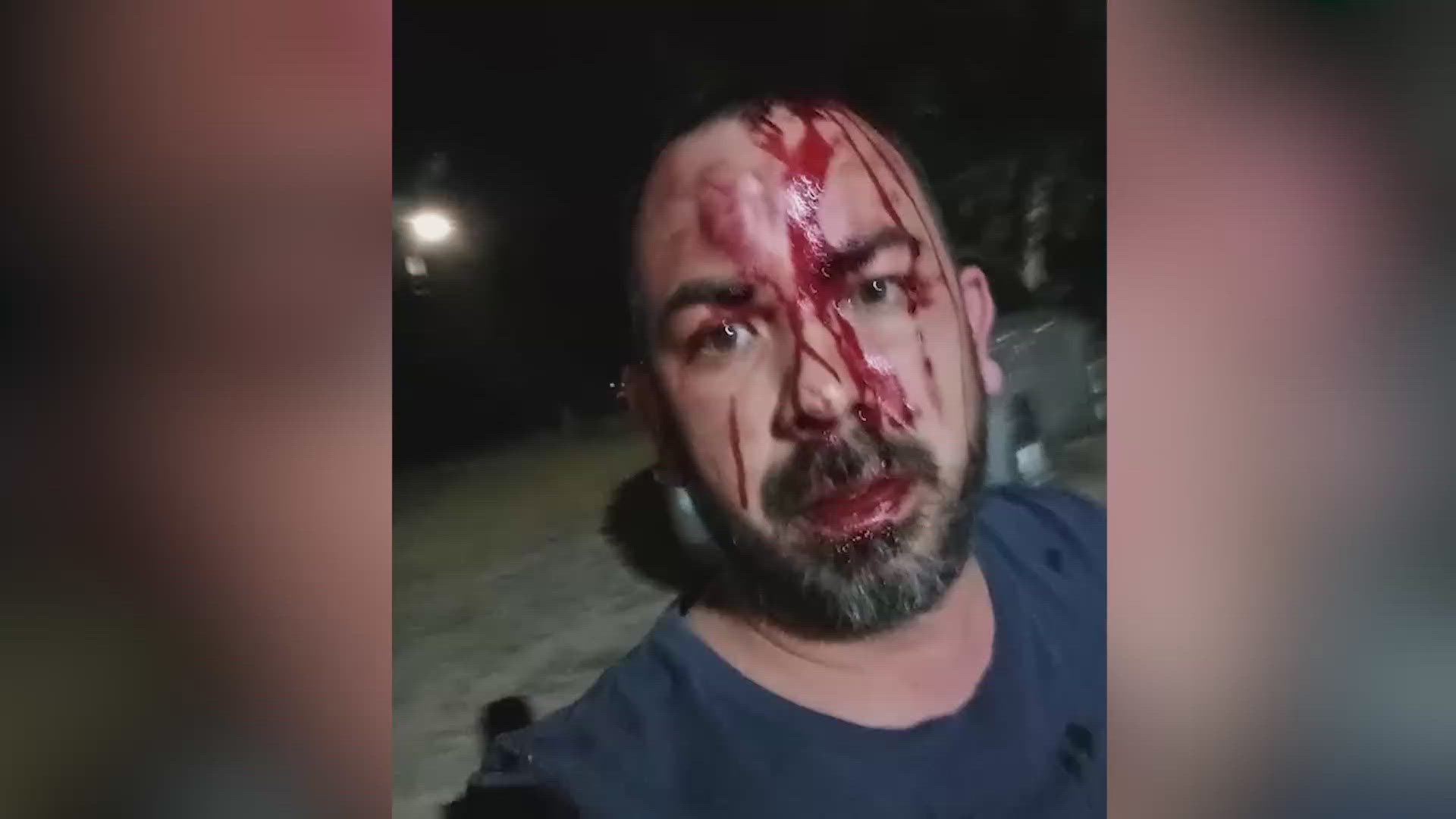 Lytle man's demands for bar owner to move cars off property ends in bloody scuffle