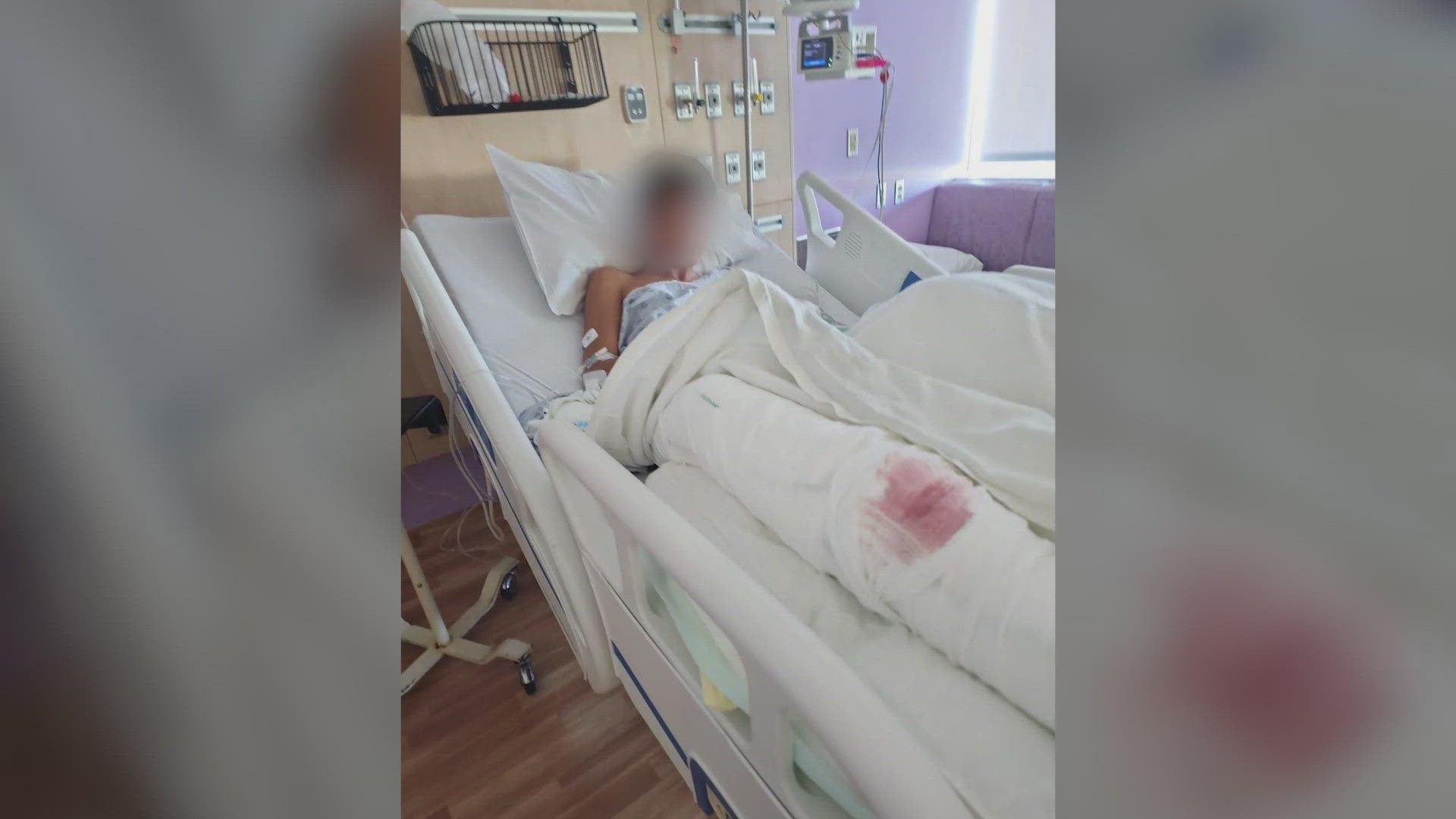 15-year-old hospitalized after hit-and-run recalls the terrifying moments