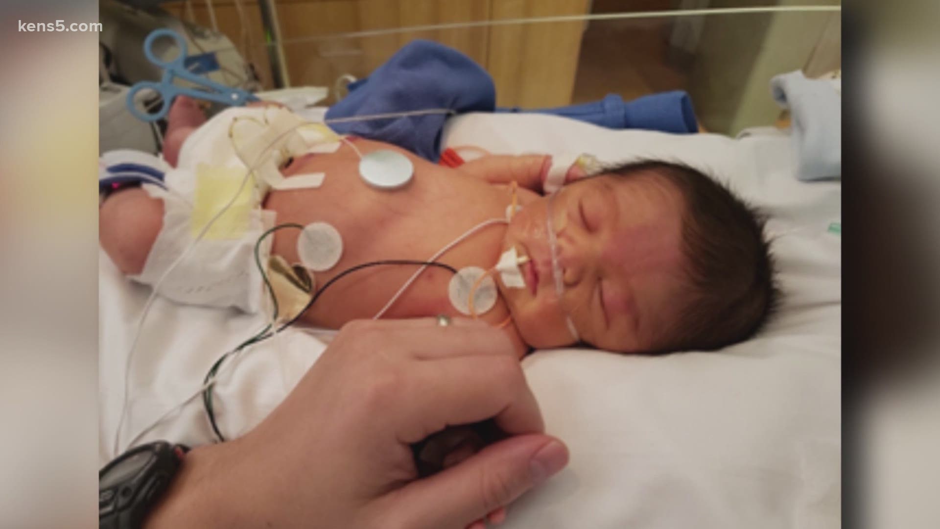 Baby CJ Everett was born prematurely with a condition that filled his kidneys with cysts and could have killed him.