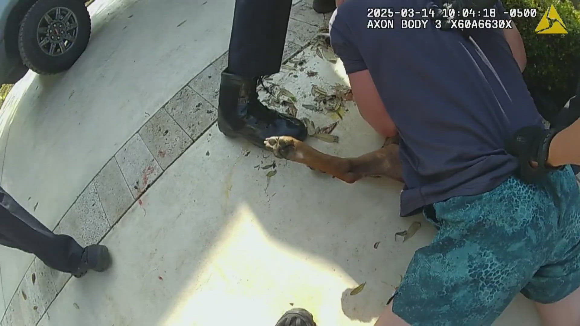 Lowe says he was wafting smoke away when the dog nipped his fingers, then bit through his shoes. The next day, the dog got loose and attacked him.