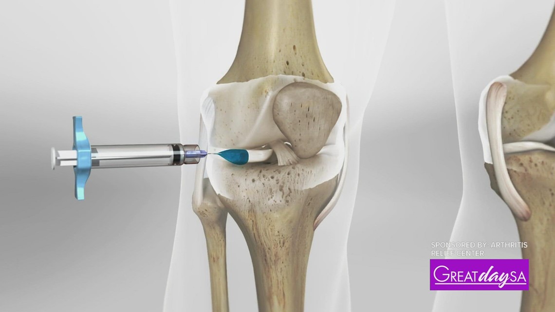 This Non-surgical Knee Treatment Can Help Relieve Arthritis Pain ...