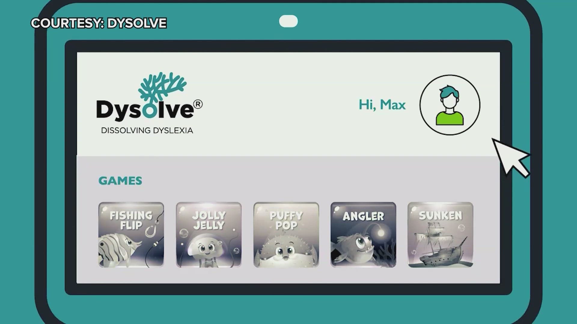 Dysolve AI uses short brain games to lessen the severity of the condition.