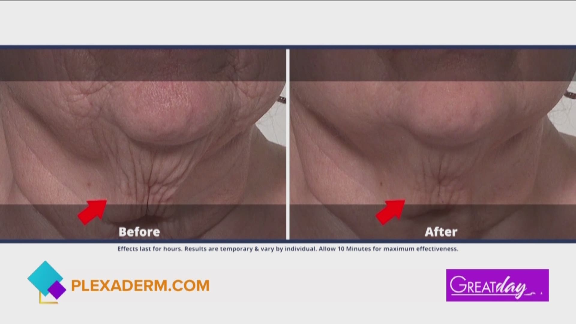 Plexaderm is helping men and women slow the aging process at home! Their serum dries in just 10 seconds and results last!
