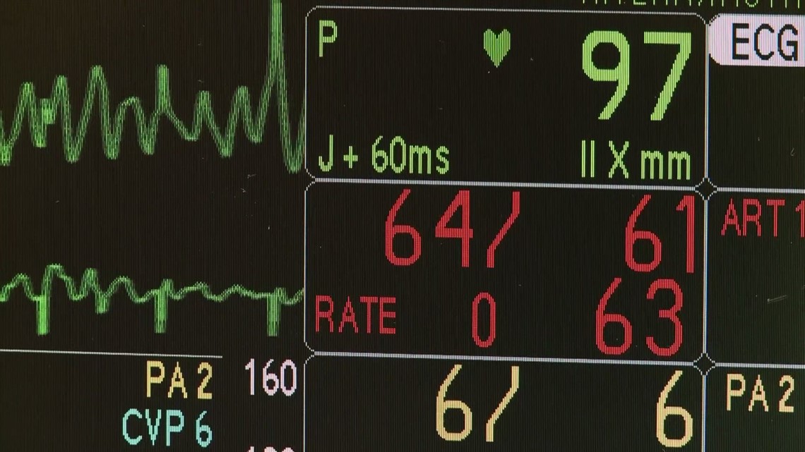 Can AI predict a heart attack? Here's what one study says. - Vimarsana News