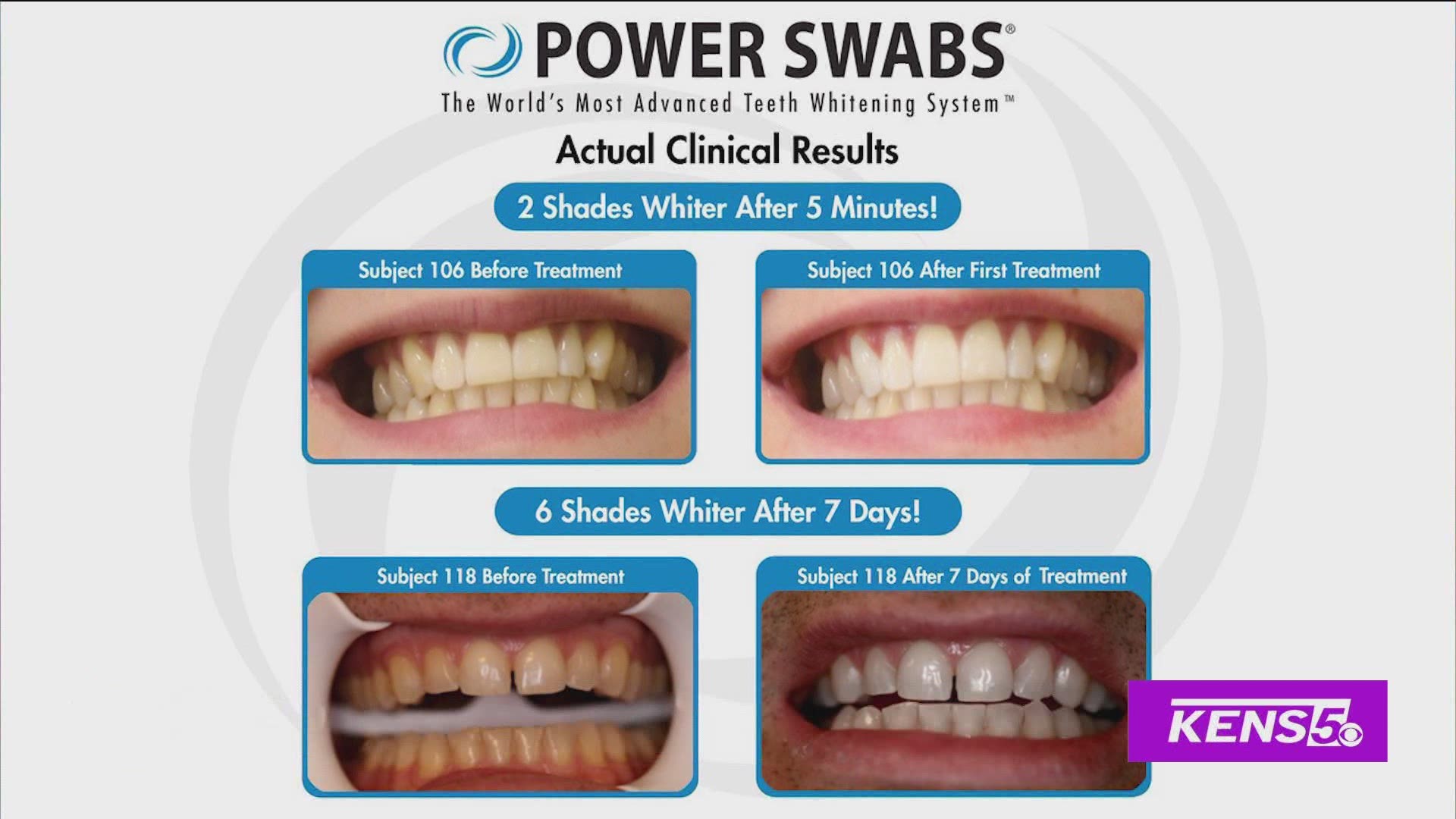 You don't need to go to a dentist to have a brighter and whiter smile, Power Swabs shows you why!