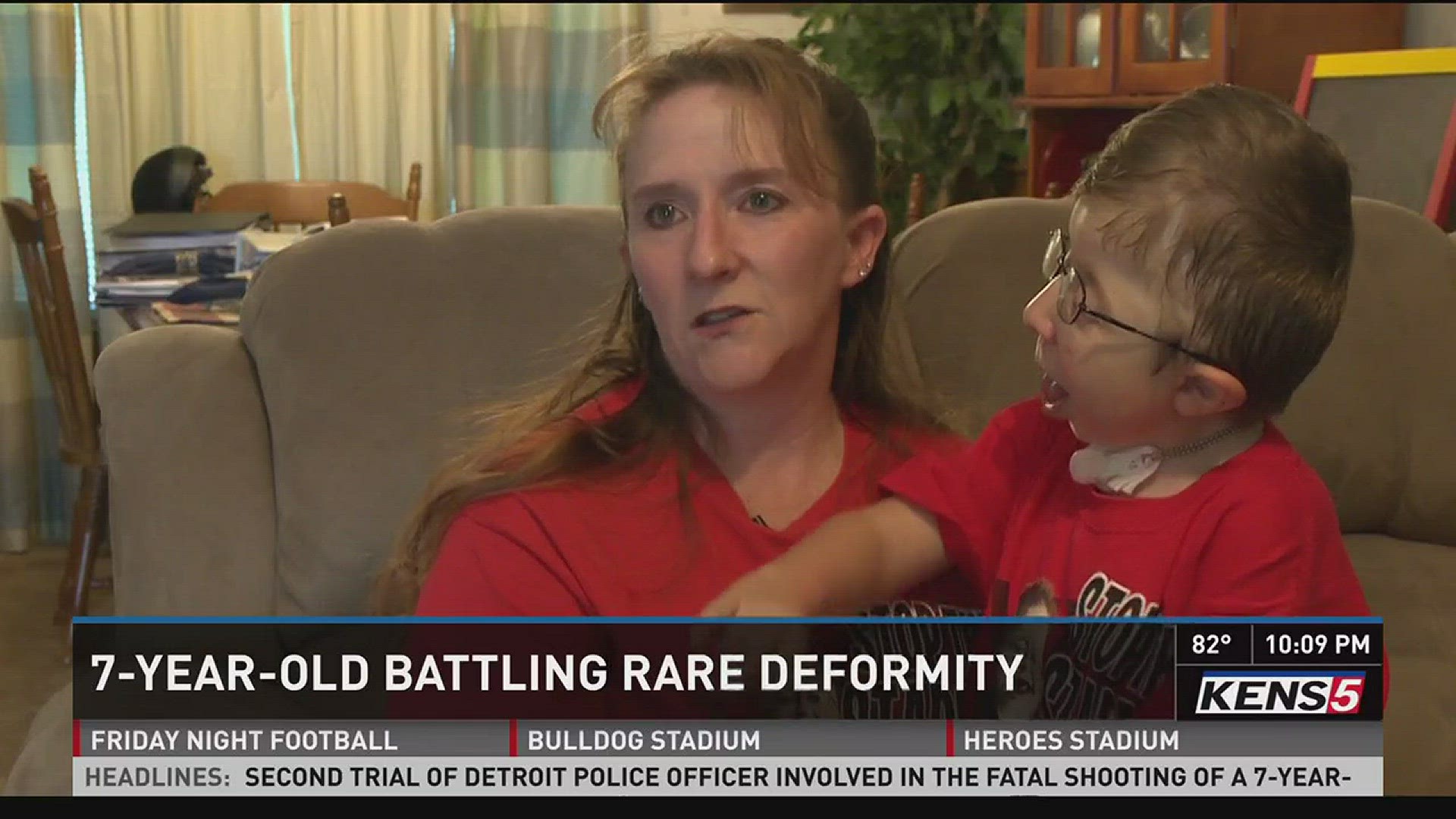 Young boy battling rare deformity