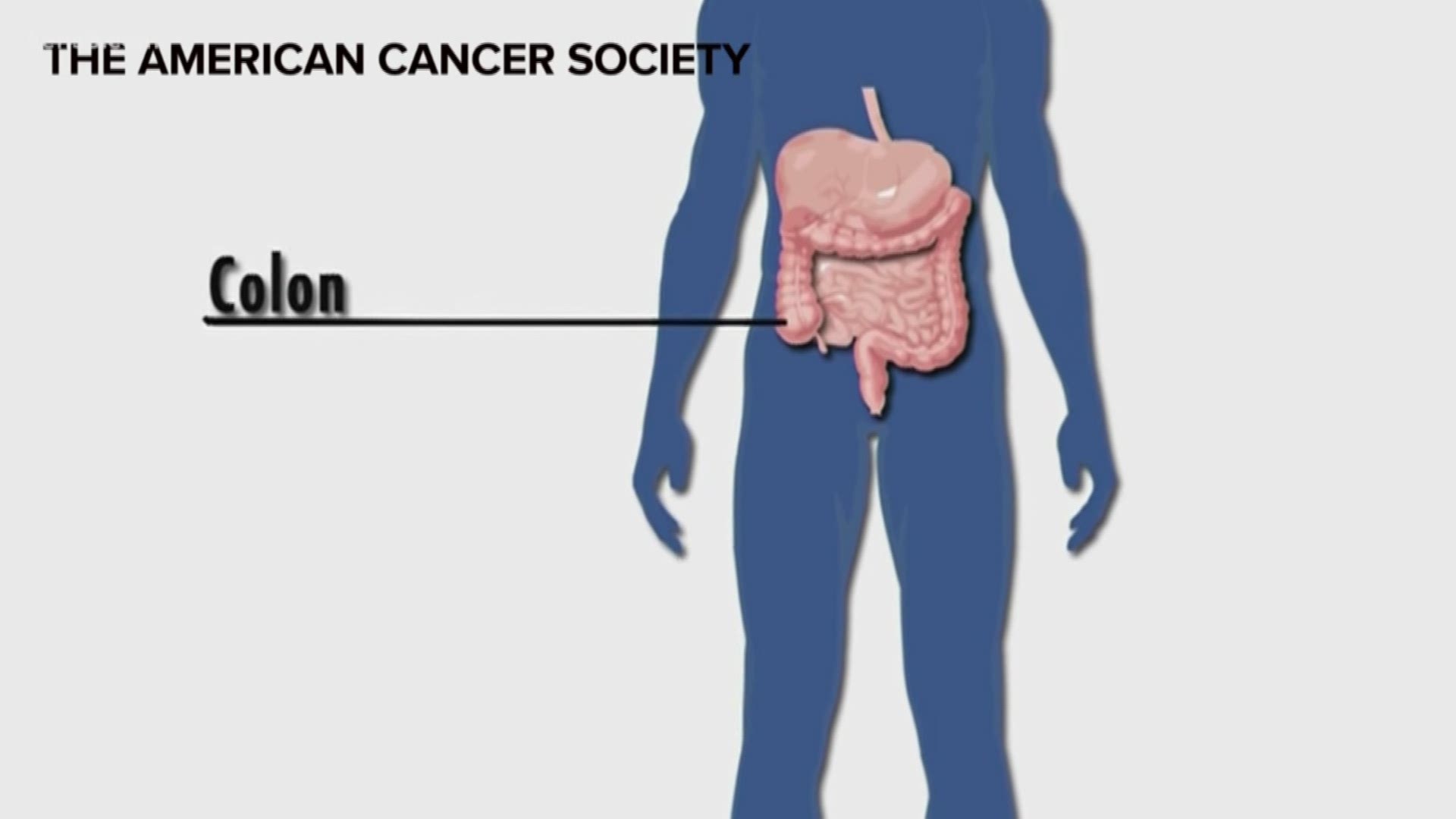 Every year in the U.S. more than 50,000 people die from colon cancer, which doctors say is a very preventable disease. Eyewitness News reporter Jeremy Baker explains.