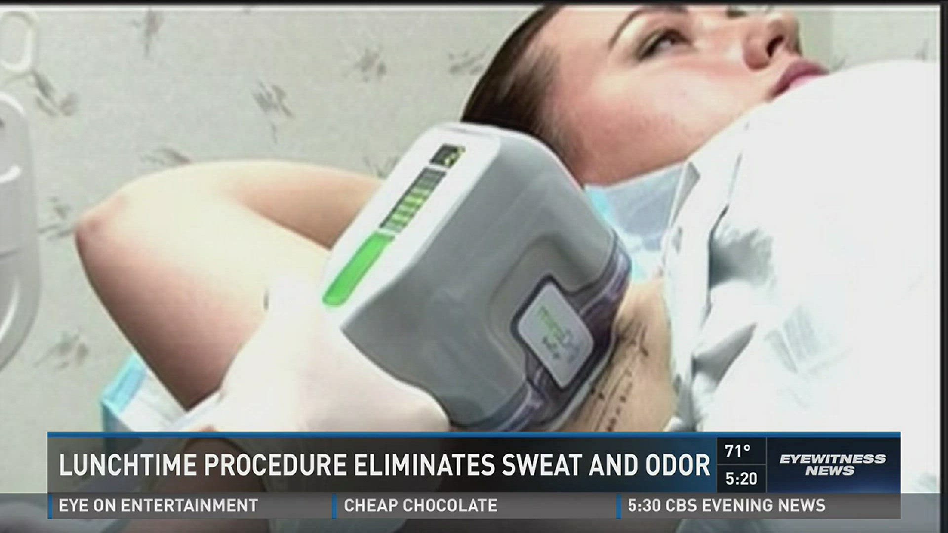 Lunchtime procedure eliminates sweat and odor