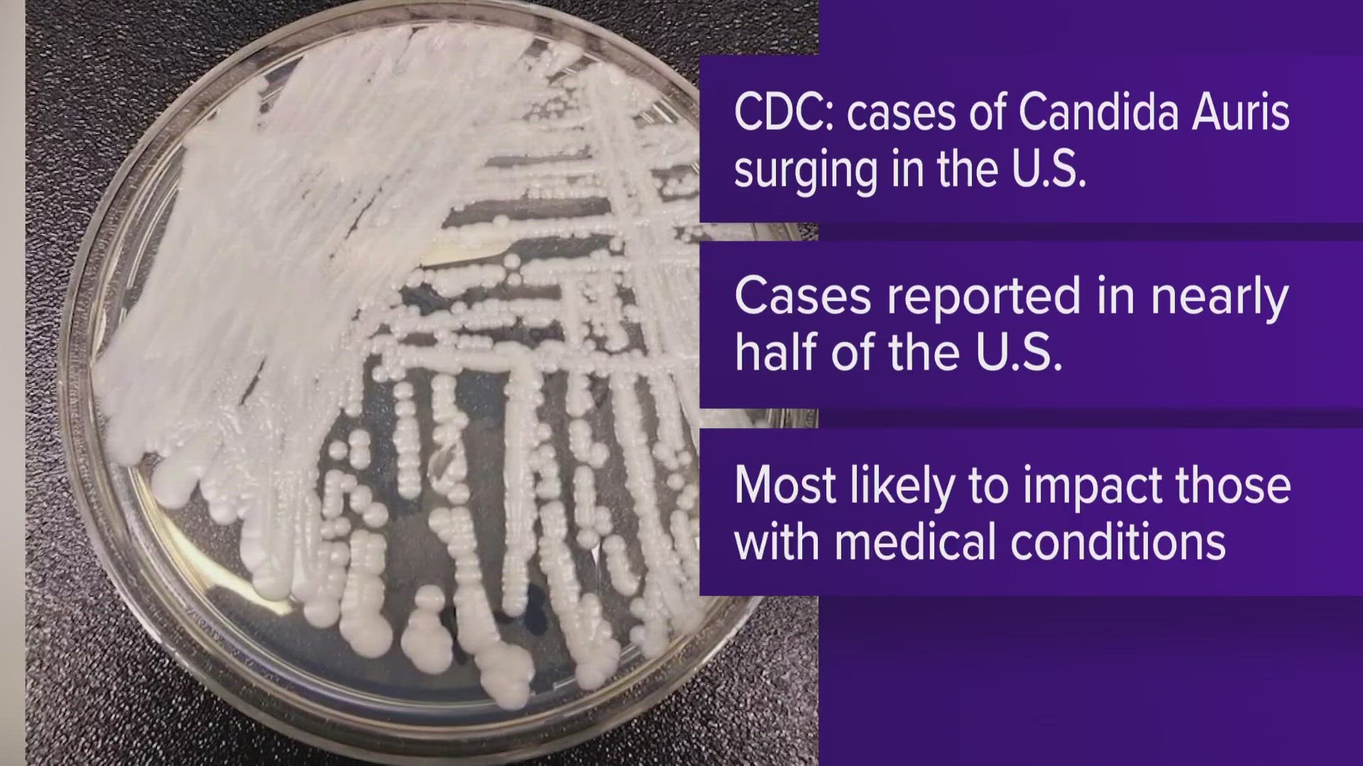 The spread of Candida auris may have worsened due to the strain COVID-19 put on the health care system, researchers said.