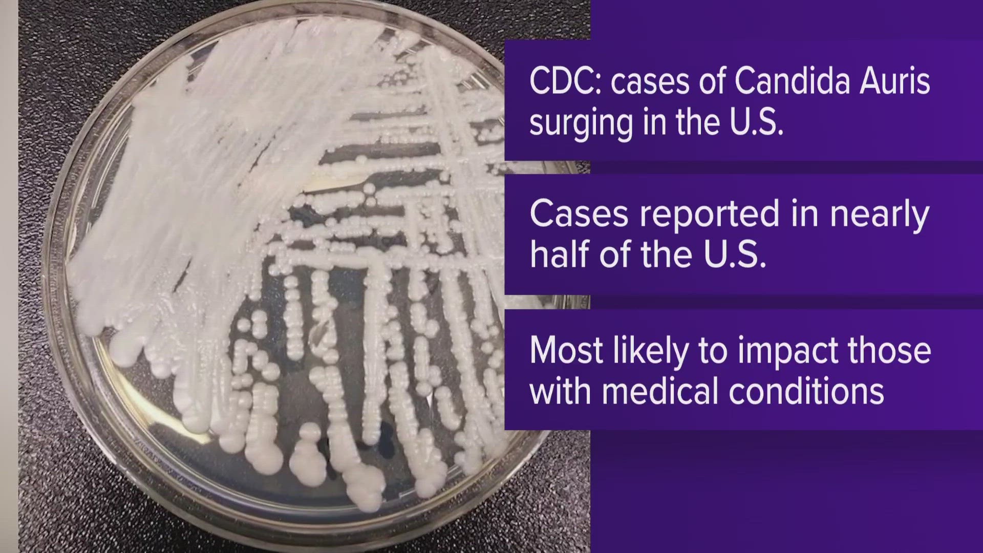 Candida Auris Drug resistant Fungus Spreading In US CDC Says Kens5