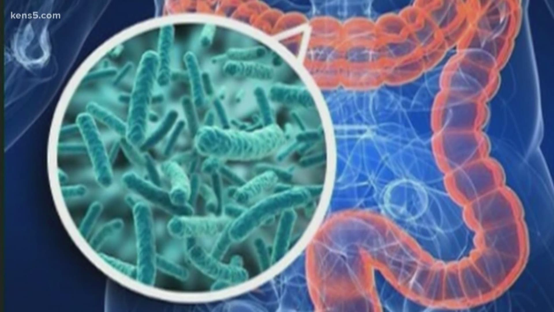 Well over 100,000 people in the U.S. will be diagnosed with colorectal cancer this year, and close to half of them will die. Eyewitness News reporter Jeremy Baker introduces us to one woman who caught the disease early, and is living to spread awareness about the need to get screened.