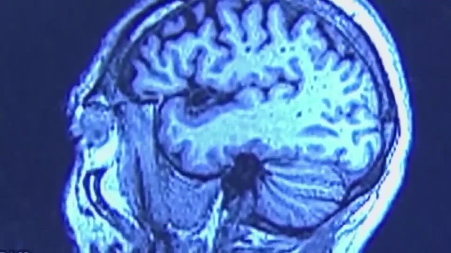 Healthy SA: Recognizing the signs of a concussion, image size:1920x1080