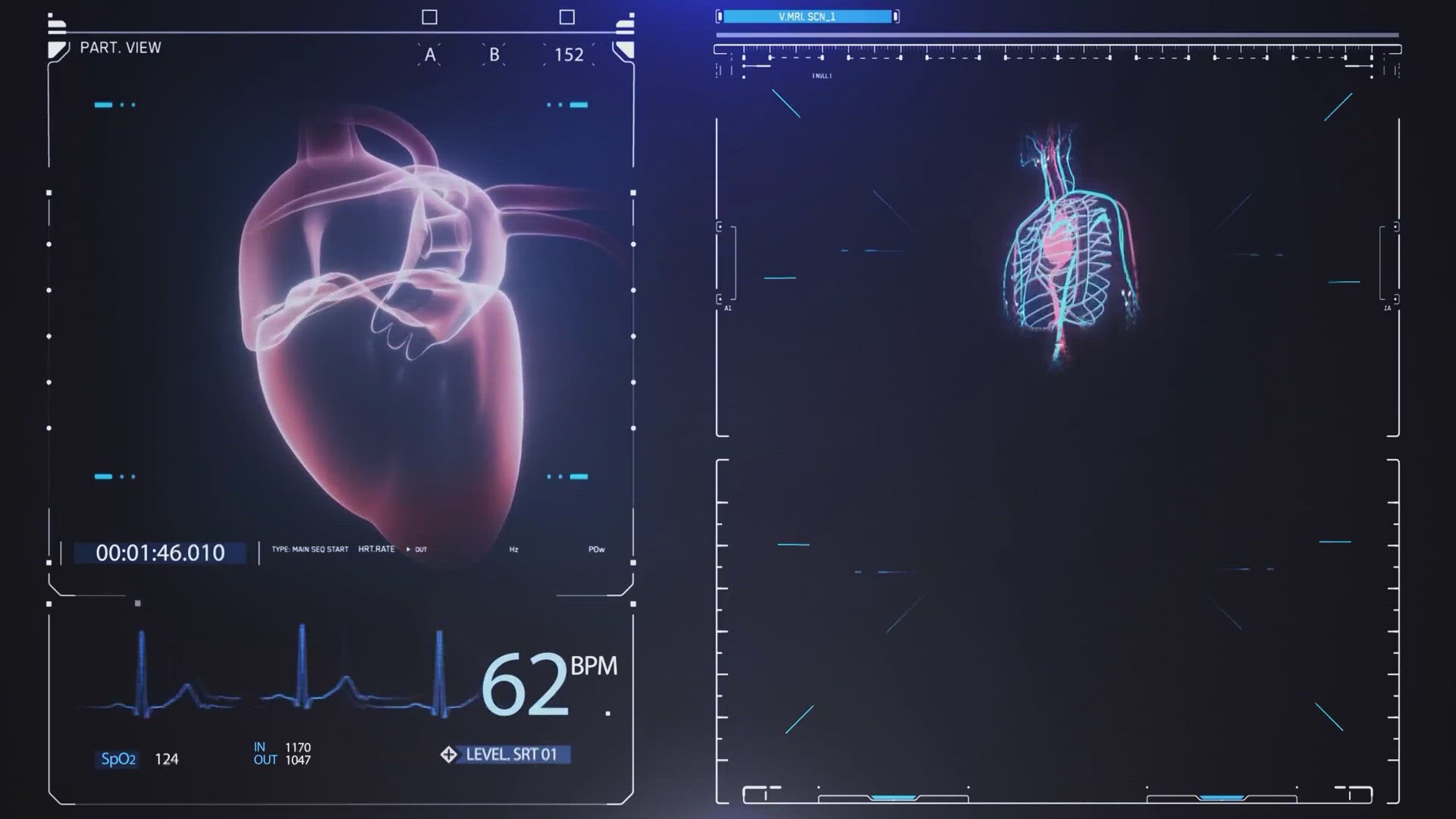 When you get angry blood vessels constrict making it easier to have heart and circulation issues