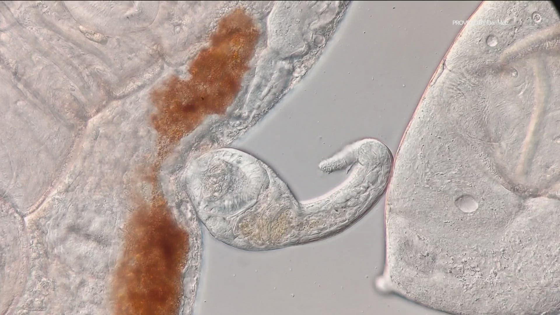 A trematode is a type of parasitic flatworm. It's an invasive species and can be harmful to humans.