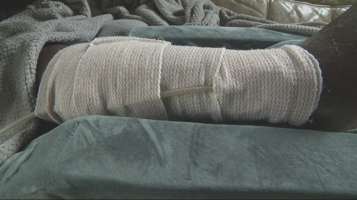 Woman recovering after dog attack during morning walk in Northeast ...