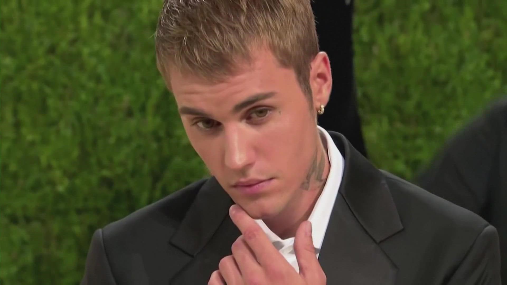 Singer-songwriter Justin Bieber announced he has contracted a serious complication from a recent virus that has paralyzed the right side of his face completely.