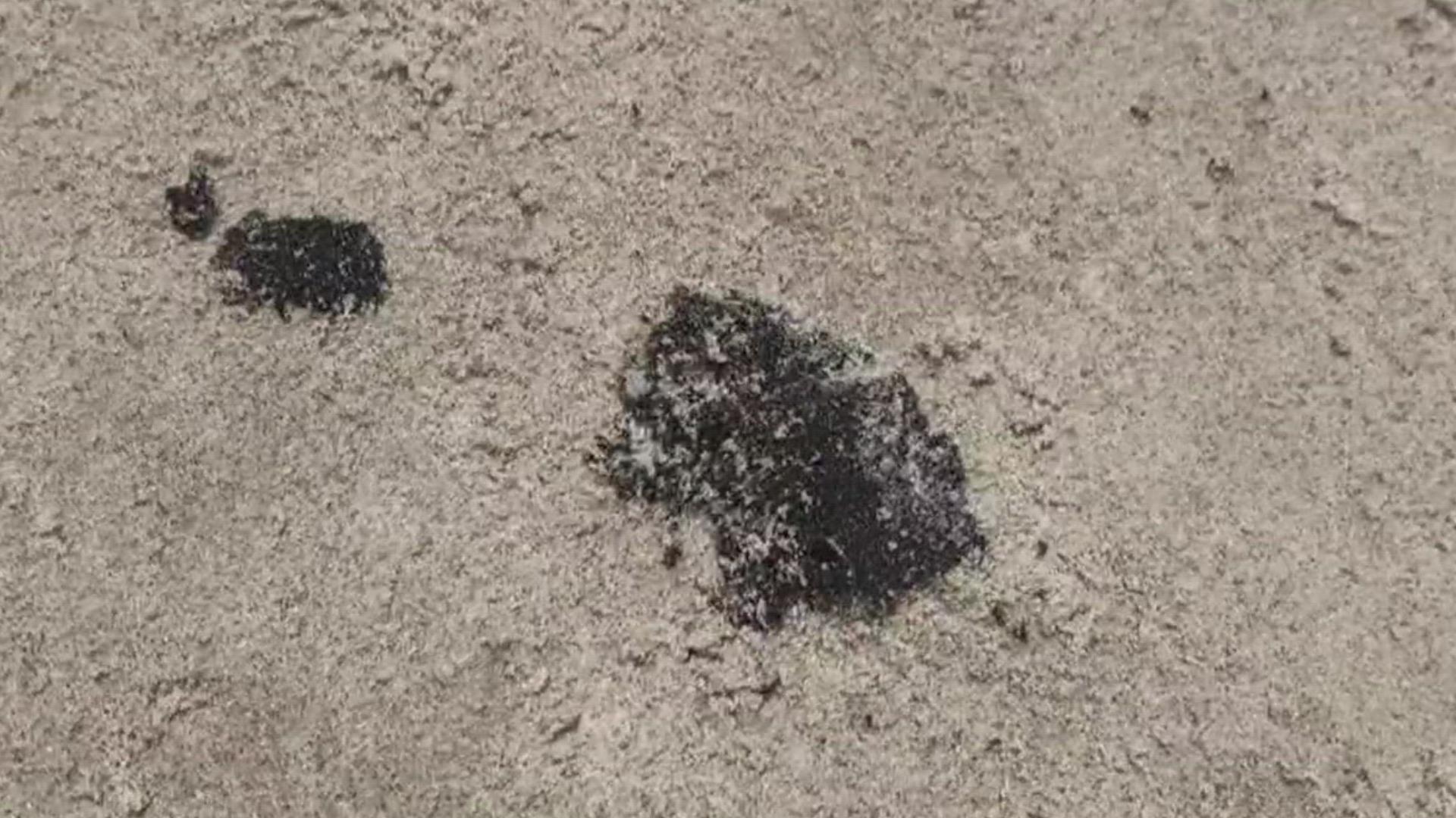 If you get some of the tar stuck on you while at the beach, officials say it can be removed with baby oil.