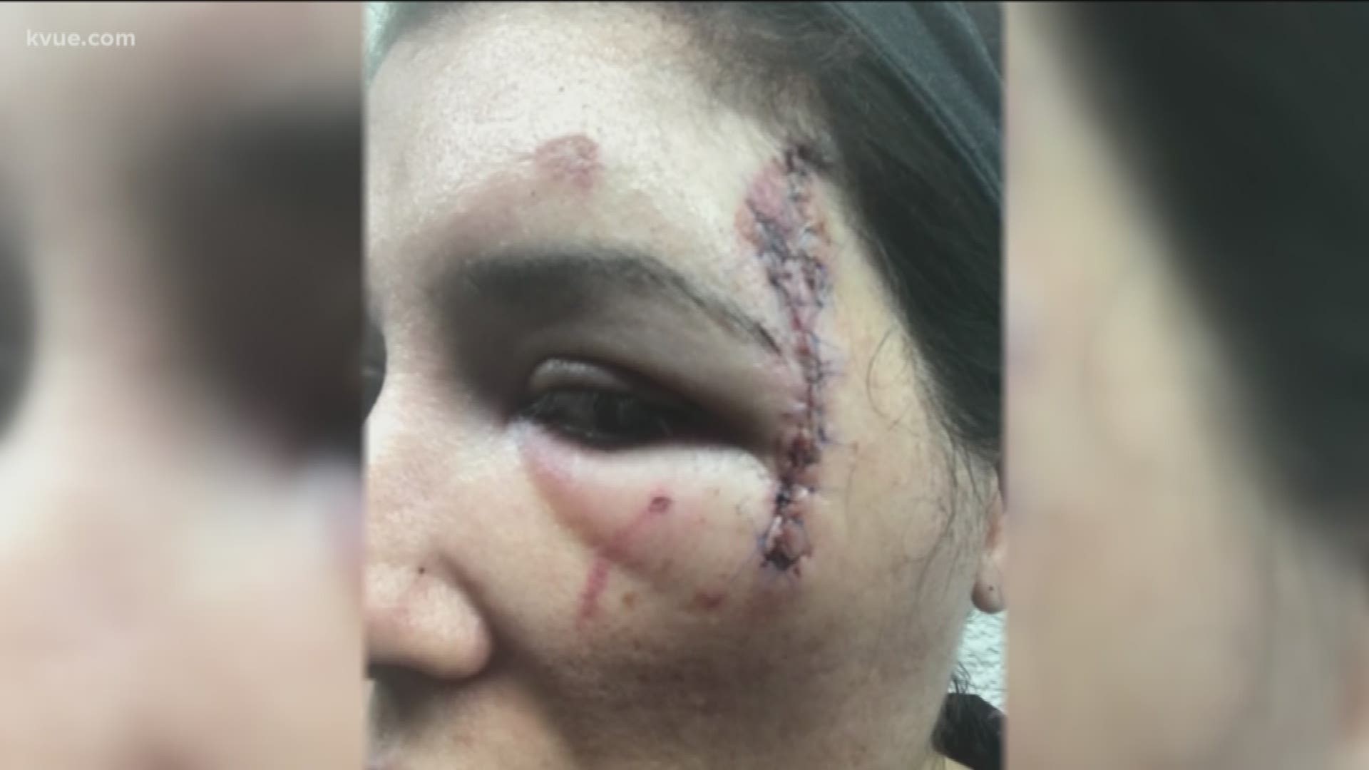 A woman is suing two Austin police officers after she said they threw her in their patrol car, causing her to cut her head.
