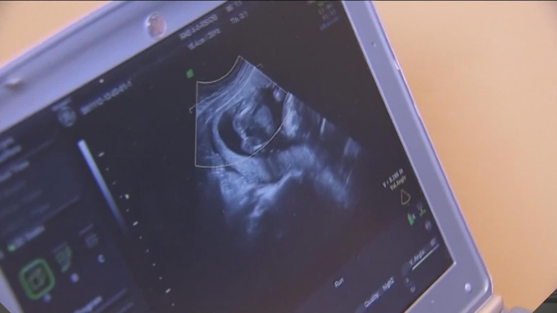 A new report shows about one in five Texas OB/GYNs have thought about leaving because of the state's abortion ban.