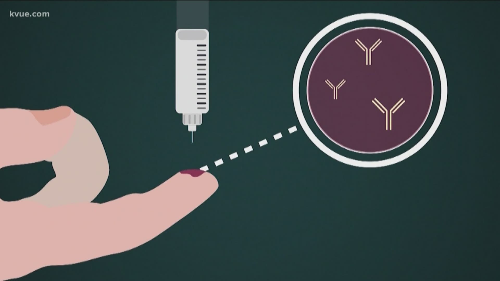 Bryce Newberry tells you what you need to know before paying for a certain type of antibody test.