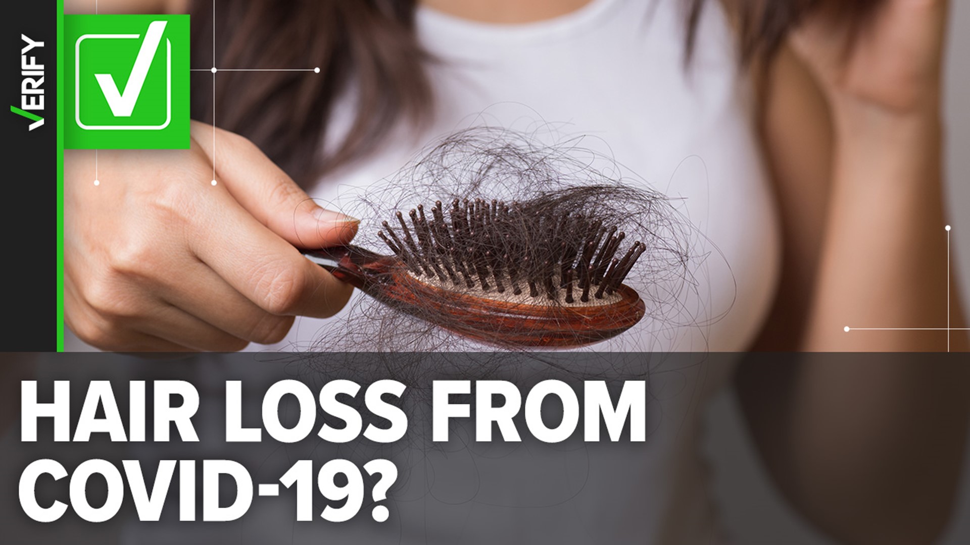 Temporary hair loss or excessive hair shedding is normal after a fever or illness, such as COVID-19. Pandemic-related stress is another possible factor.