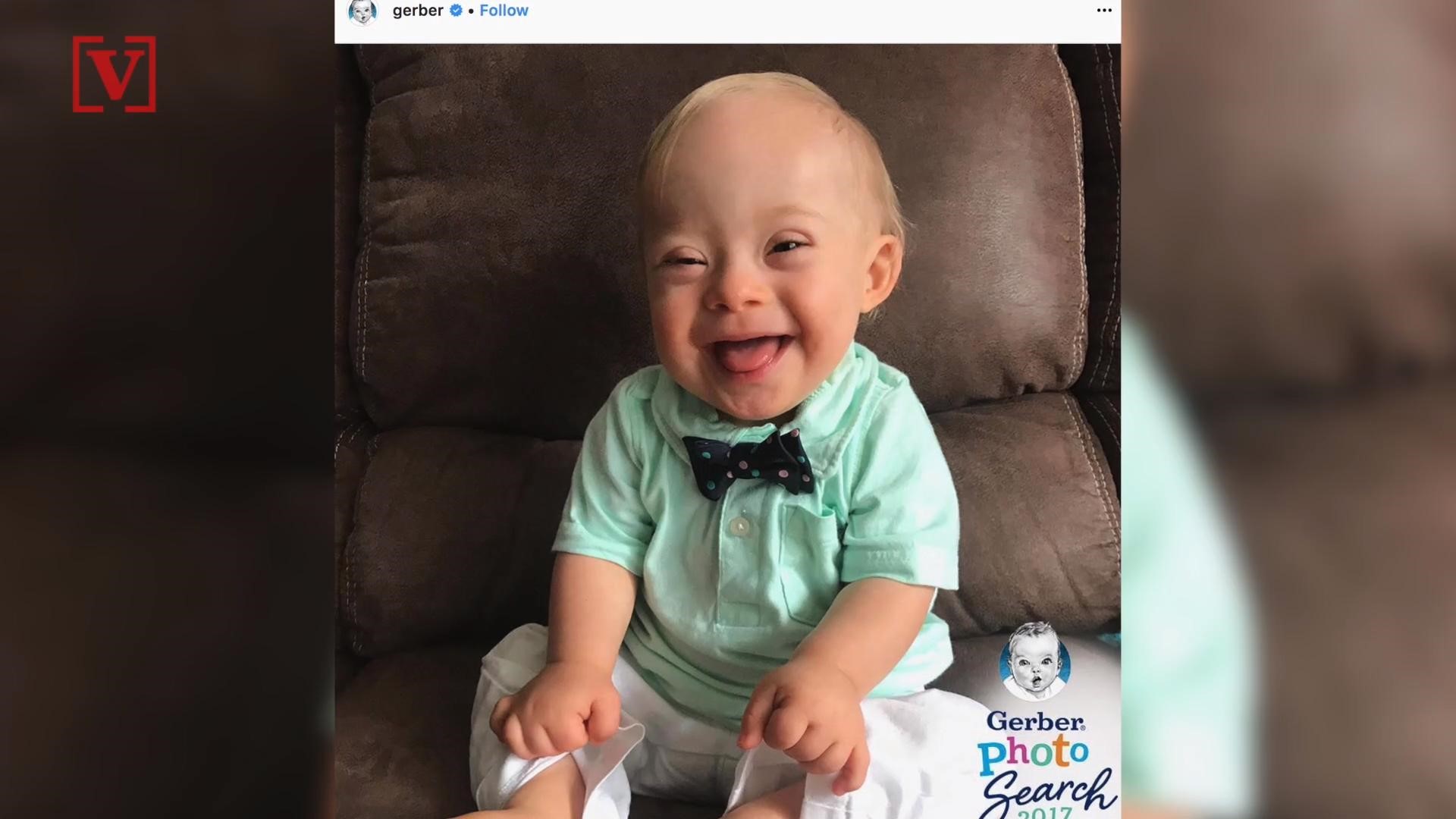 The photo of baby Lucas was submitted by his mother because people always comment on his smile. Veuer's Josh King has more.