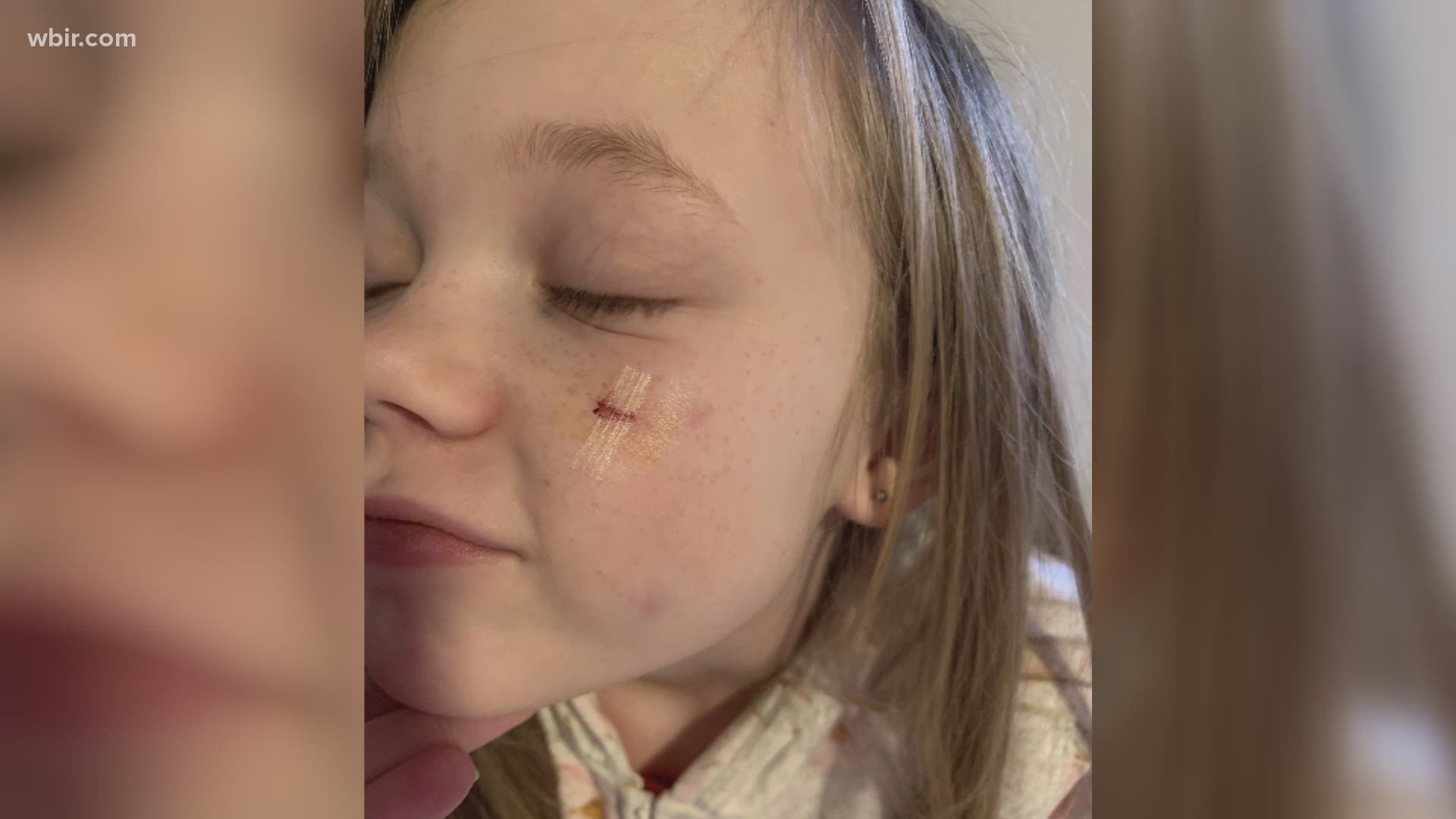 Knox County mom speaks out after neighbor's dog attacks daughter twice.