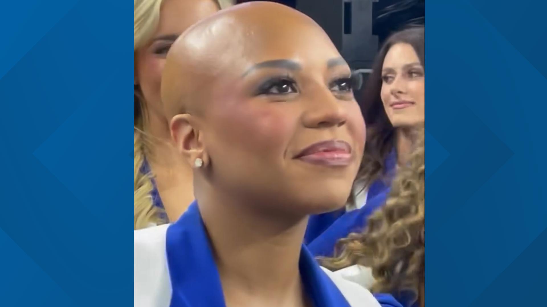 Cowboys Cheerleader Cheers Without Wig For Alopecia Awareness | Kens5.com