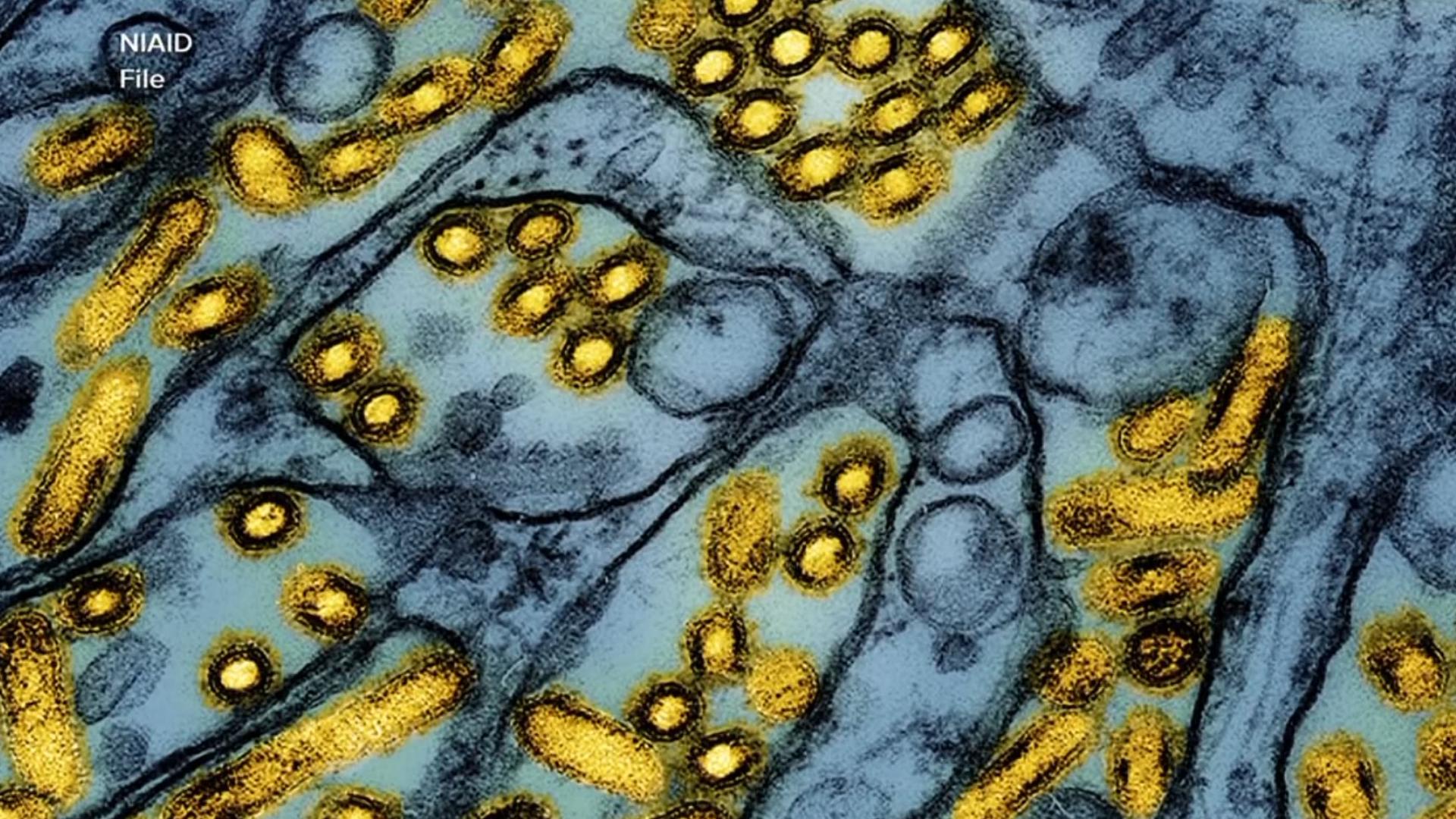 Local officials say the state health department confirmed the virus was detected in a wild bird that was found dead in North Austin.