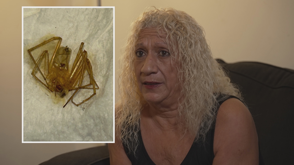 Woman claims spider bites led to toe amputation, sues Florida apartment management