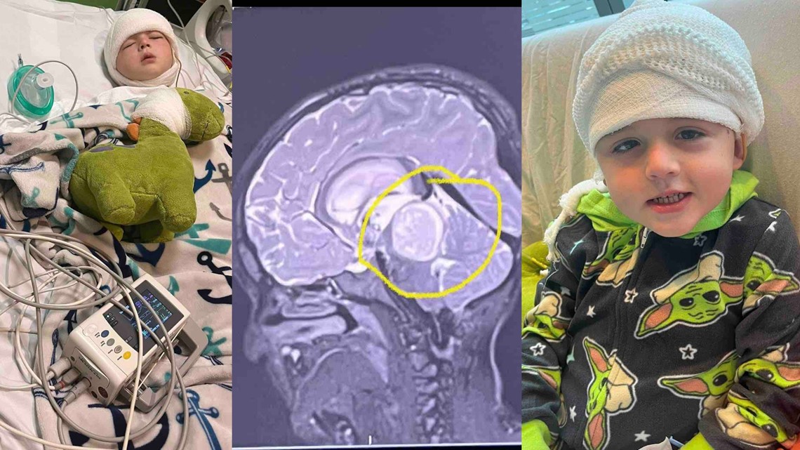 Michigan mom tells story of saving son from golf ball-sized tumor ...
